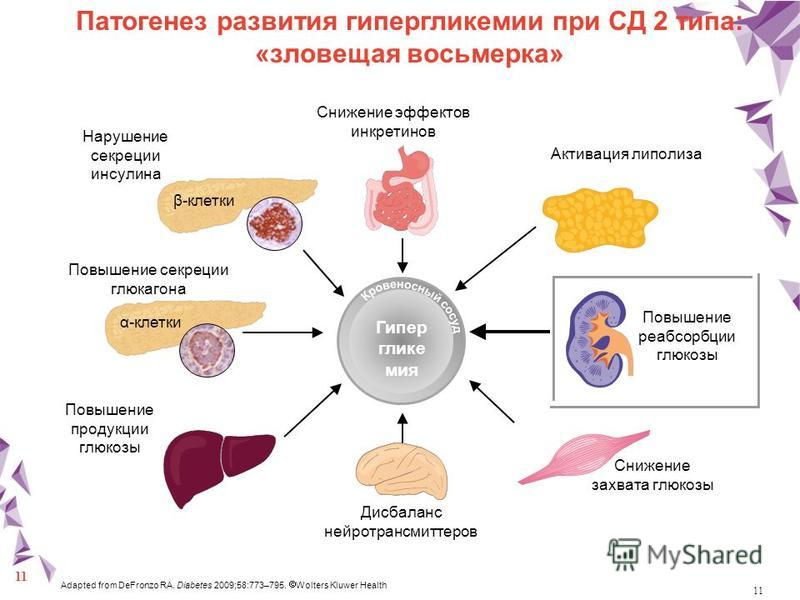 Лечение сахарного диабета 2 типа презентация