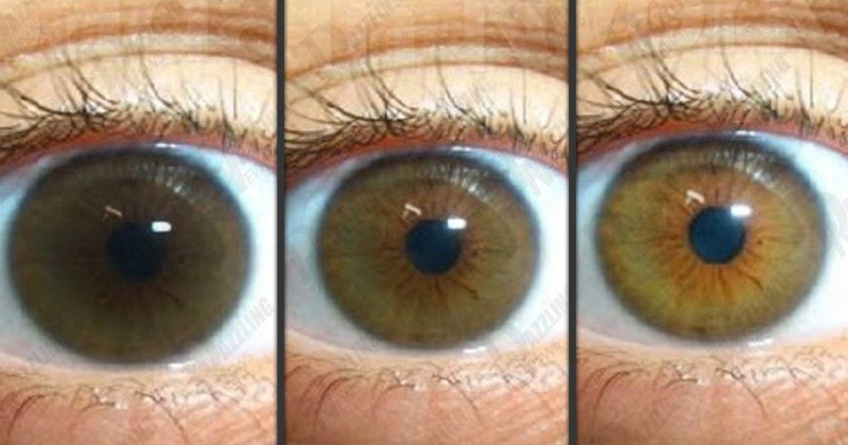 меняется ли в течение жизни цвет глаз у человека