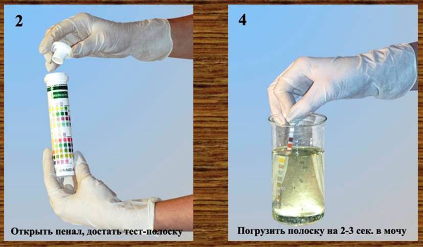 Тест для определения белка в моче. Метод Брандберга Робертса Стольникова моча. Проба с 20 сульфосалициловой кислотой моча. Проба на белок в моче. Проба Геллера с азотной кислотой.