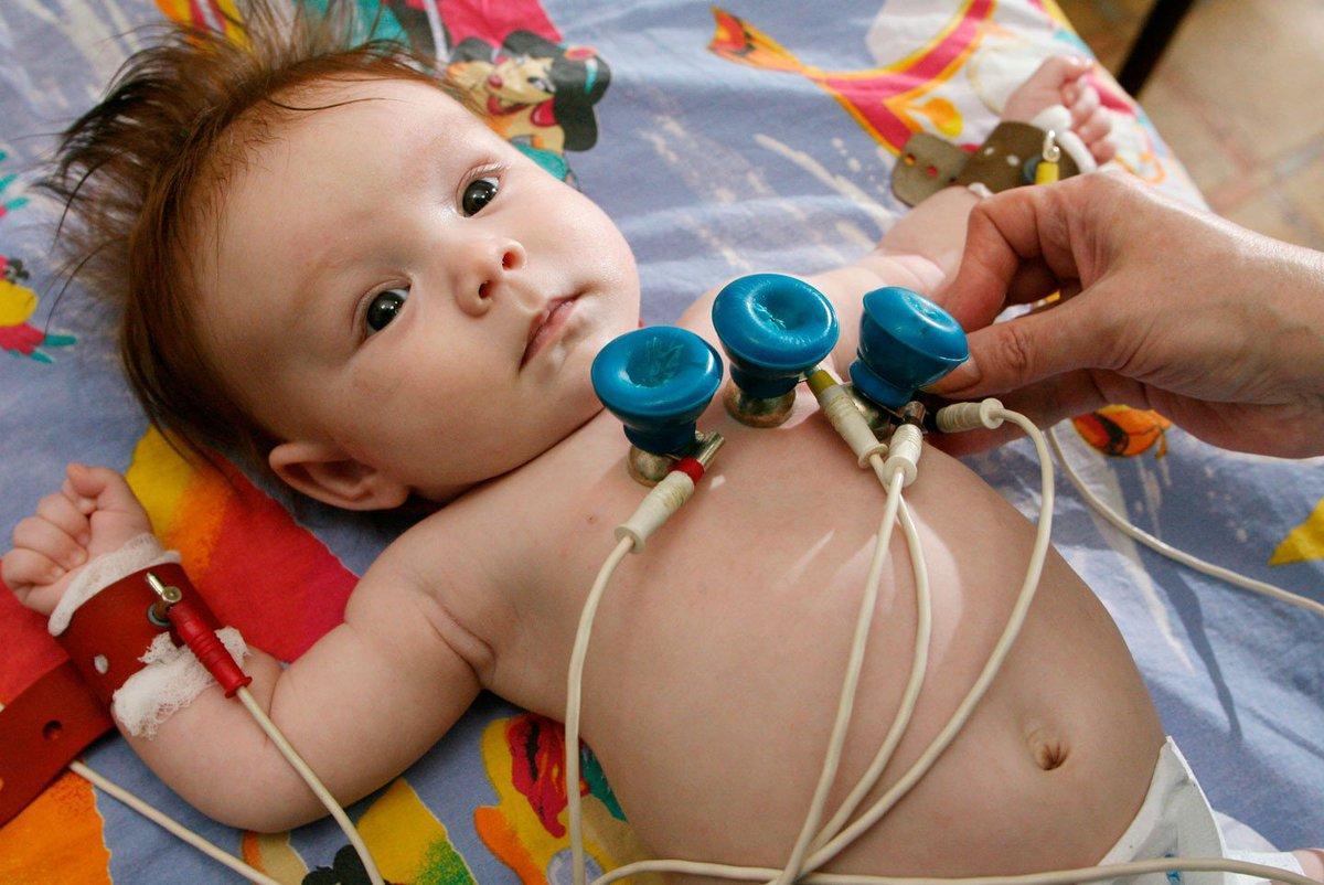 Электрокардиограмма младенца
