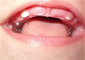 Сколько молочных зубов должно быть у ребенка в 2 года, как происходит процесс прорезывания?