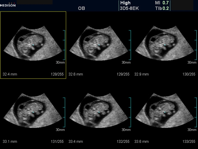 Снимки эмбриона